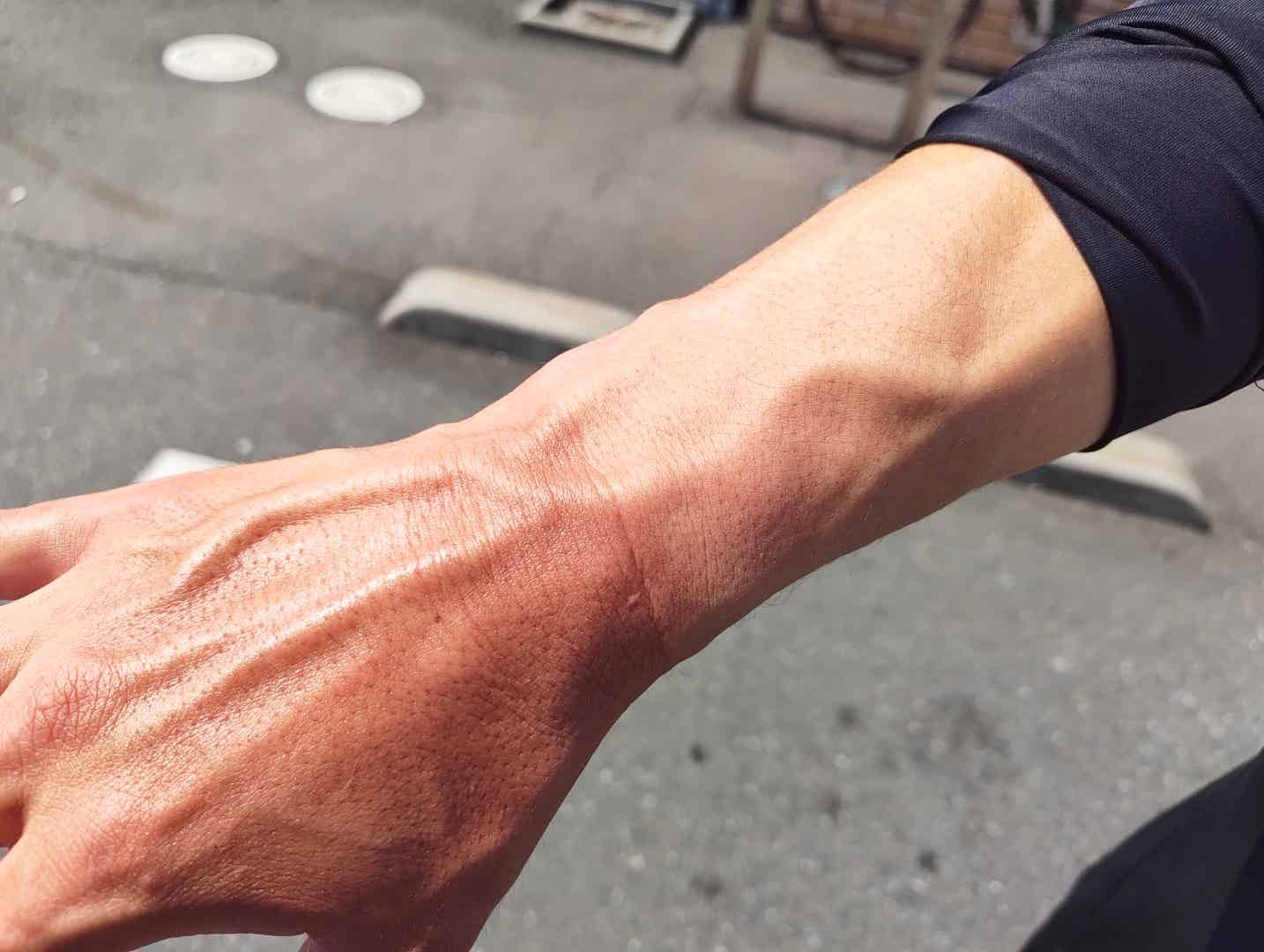 ワークマン夏用インナーの日焼け跡